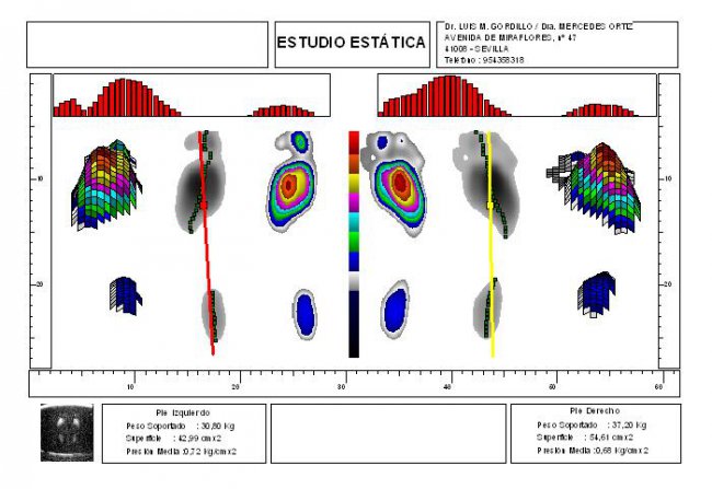 BALONCESTO, BALONMANO Y VOLEIBOL