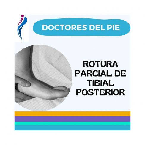 ROTURA PARCIAL DEL TIBIAL POSTERIOR