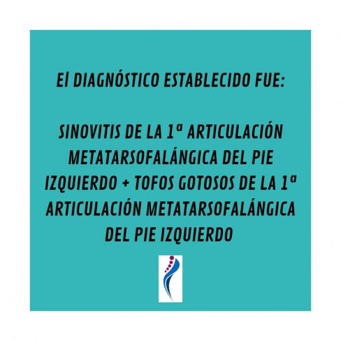 TOFOS GOTOSOS EN PRIMERA ARTICULACIÓN METATARSOFALÁNGICA