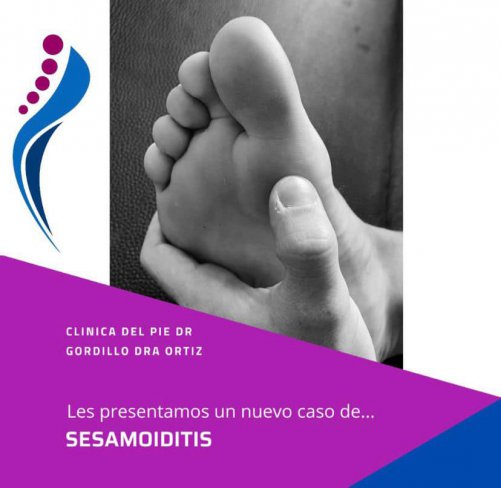 SESAMOIDITIS/FRACTURA DE ESTRÉS