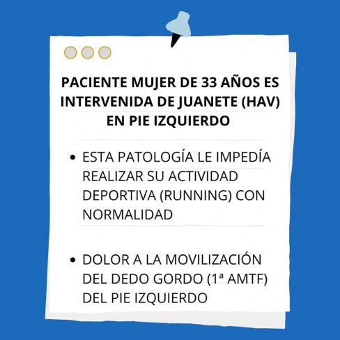 CIRUGÍA DE JUANETE (HALLUX VALGUS) EN PACIENTE JÓVEN