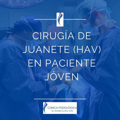 CIRUGÍA DE JUANETE (HALLUX VALGUS) EN PACIENTE JÓVEN