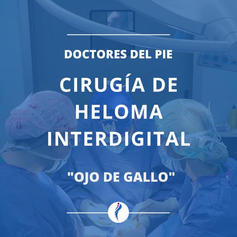 CIRUGÍA DE HELOMA INTERDIGITAL O COMÚNMENTE CONOCIDO COMO "OJO DE GALLO"