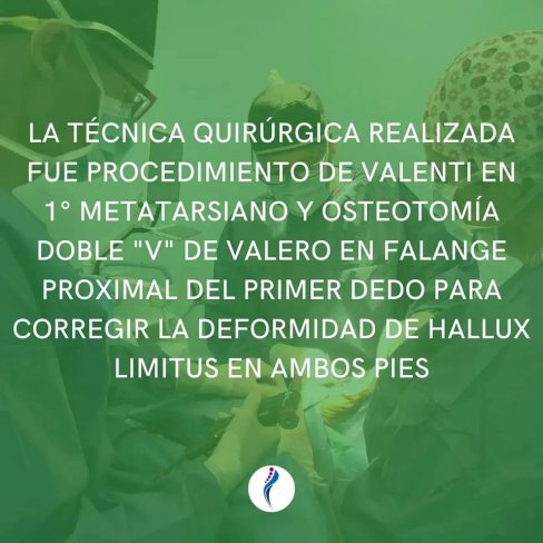 CIRUGÍA DE HALLUX RIGIDUS