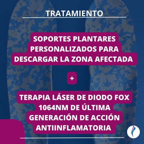 CAPSULITIS DE LA 2ª ARTICULACIÓN METATARSOFALÁNGICA