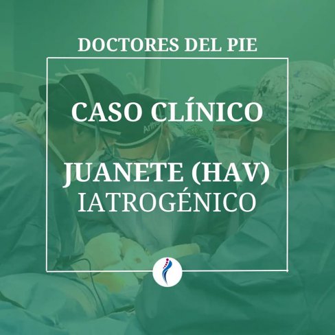 CIRUGÍA DE JUANETE (HALLUX VALGUS) IATROGÉNICO 