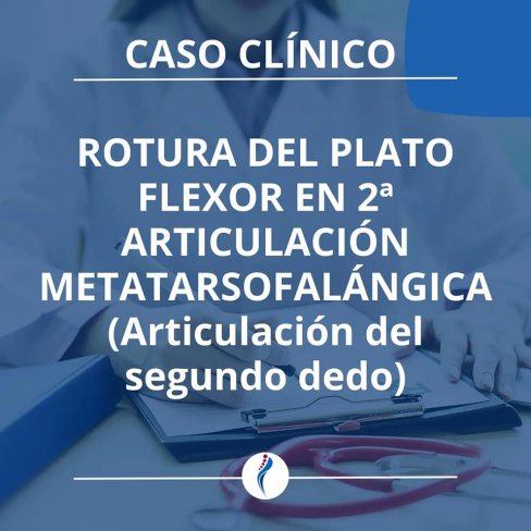 ROTURA DEL PLATO FLEXOR EN 2ª ARTICULACIÓN METATARSOFALÁNGICA (Articulación del segundo dedo)