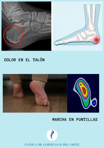 VUELTA AL COLE