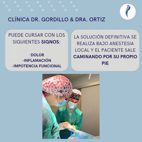 ONICOCRIPTOSIS(UÑA ENCARNADA) PRIMER DEDO BILATERAL