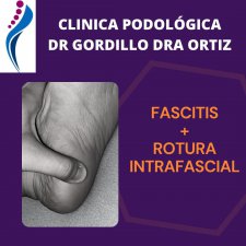 ROTURA INTRAFASCIAL