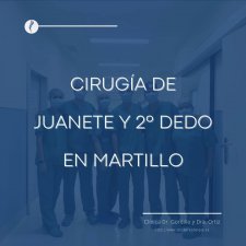 CIRUGA DE JUANETE Y 2 DEDO EN MARTILLO