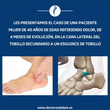 OSTEOFITOS EN LIGAMENTO PERONEO-ASTRAGALINO ANTERIOR